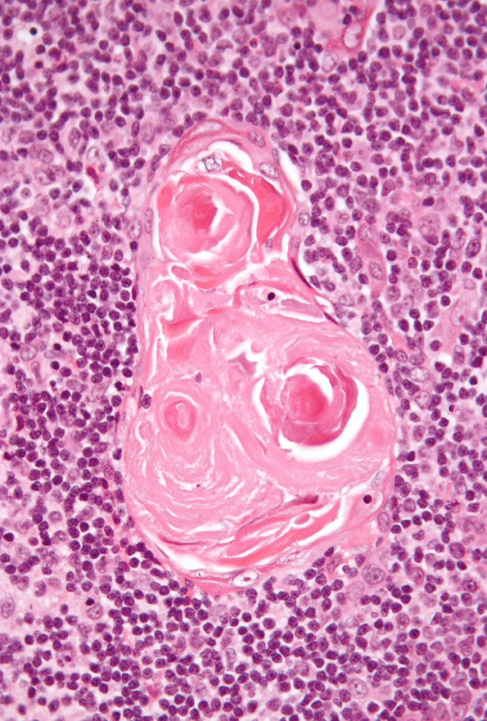 Primary Lymphoid Tissue | USMLE Strike