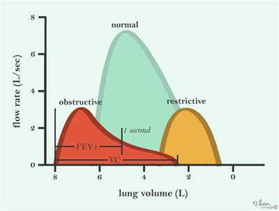 Restrictive Lung Disease | USMLE Strike